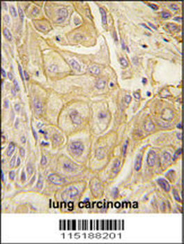 EphB2 Antibody