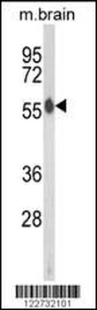 AKT2 Antibody