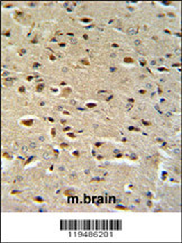 CTNA1 Antibody (N-term)