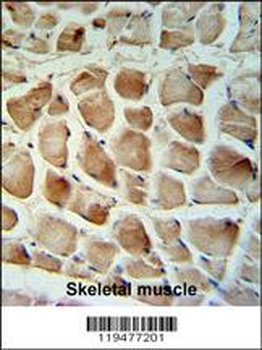 Calponin-3 Antibody (Center)