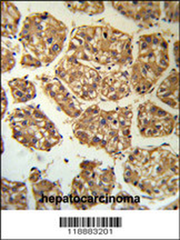 BLNK Antibody (Center)