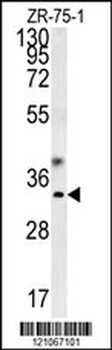 GCH1 Antibody (N-term)