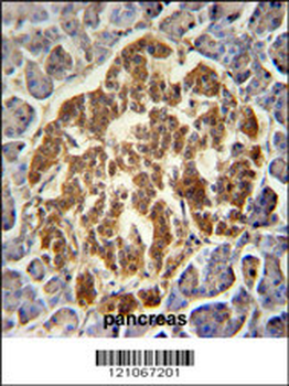 GCH1 Antibody (N-term)