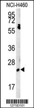 EBPL Antibody (C-term)
