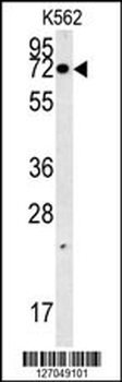 AAA1 Antibody (C-term)