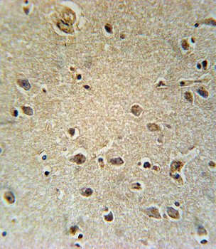 TXTP Antibody (Center)