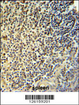 NR5A1 Antibody (N-term)