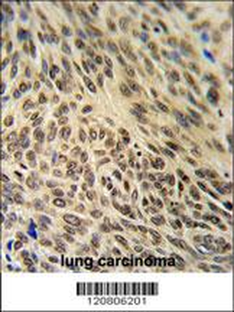 XRCC6 Antibody (C-term)
