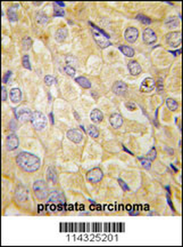 FZD1 Antibody (Center)