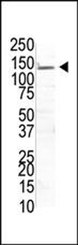 USP8 Antibody (N-term)