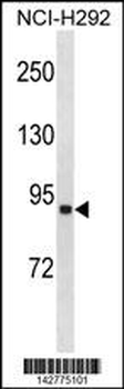 ACSL1 Antibody (C-term)