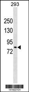 DCLK2 Antibody (N-term)