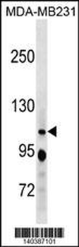 RBL1 Antibody(C-term)