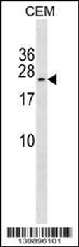TAK1L Antibody (C-term)