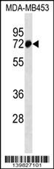 ZNF326 Antibody (N-term)