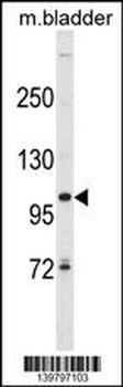 SCUBE3 Antibody (Center)