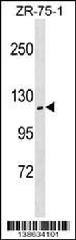 ZHX2 Antibody (N-term)
