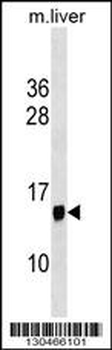 PPP1R1C Antibody (N-term)