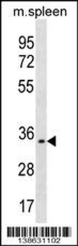 TREML1 Antibody (C-term)
