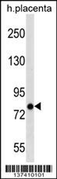 ARHGEF4 Antibody (C-term)
