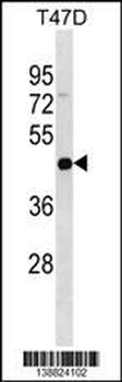 IL22RA2 Antibody (N-term)