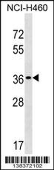 TP53TG5 Antibody (Center)