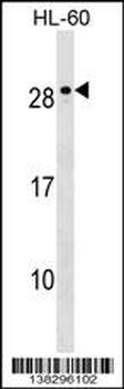 MED18 Antibody (C-term)