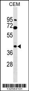 CACNG3 Antibody (N-term)