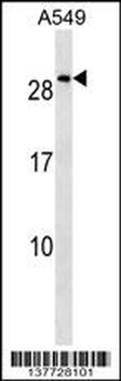 NKX2-8 Antibody (N-term)
