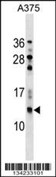 NGFRAP1 Antibody (N-term)