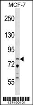 ZNF828 Antibody (Center)