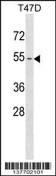 KRT79 Antibody (Center)
