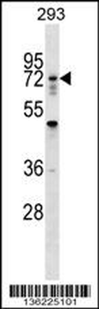 RNF112 Antibody (N-term)