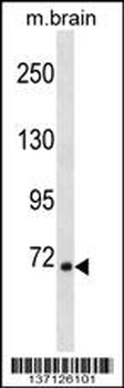 Mouse Rps6ka1 Antibody (C-term)