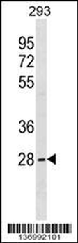 FUSIP1 Antibody (C-term)