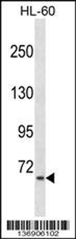 AKAP8L Antibody (C-term)