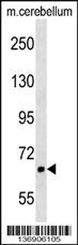 AKAP8L Antibody (C-term)