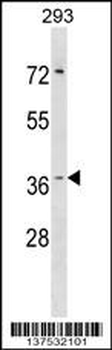 HYI Antibody (N-term)