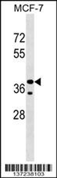 CCBE1 Antibody (Center)