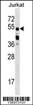 CUGBP2 Antibody (C-term)