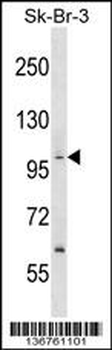 PPP1R13B Antibody (Center)