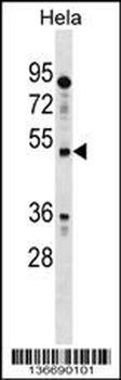 IL13RA1 Antibody (N-term)