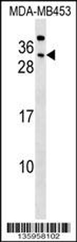 CEACAM7 Antibody (Center)