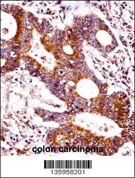 CEACAM7 Antibody (Center)