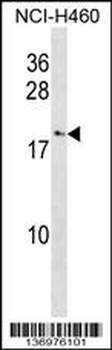 CCL27 Antibody (C-term)