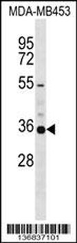 KCNA5 Antibody (C-term)