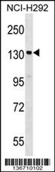 SIPA1 Antibody (C-term)