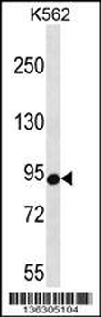 CSDE1 Antibody (C-term)