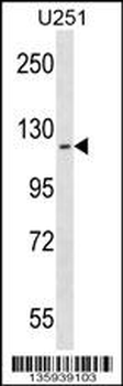 ATP13A2 Antibody (C-term)