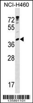 UBE2U Antibody (N-term)